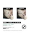 Equilibrium - Crema antiacné